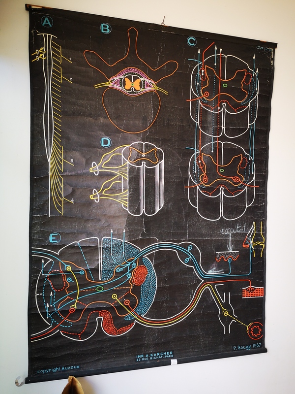 Affiche Auzoux la moelle épinière